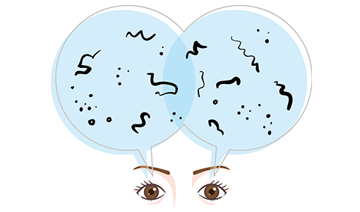 飛蚊症・網膜はく離