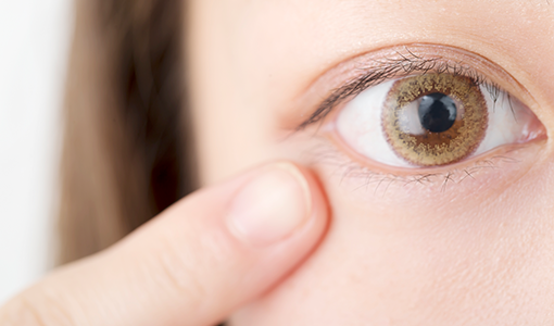 ものもらい・霰粒腫